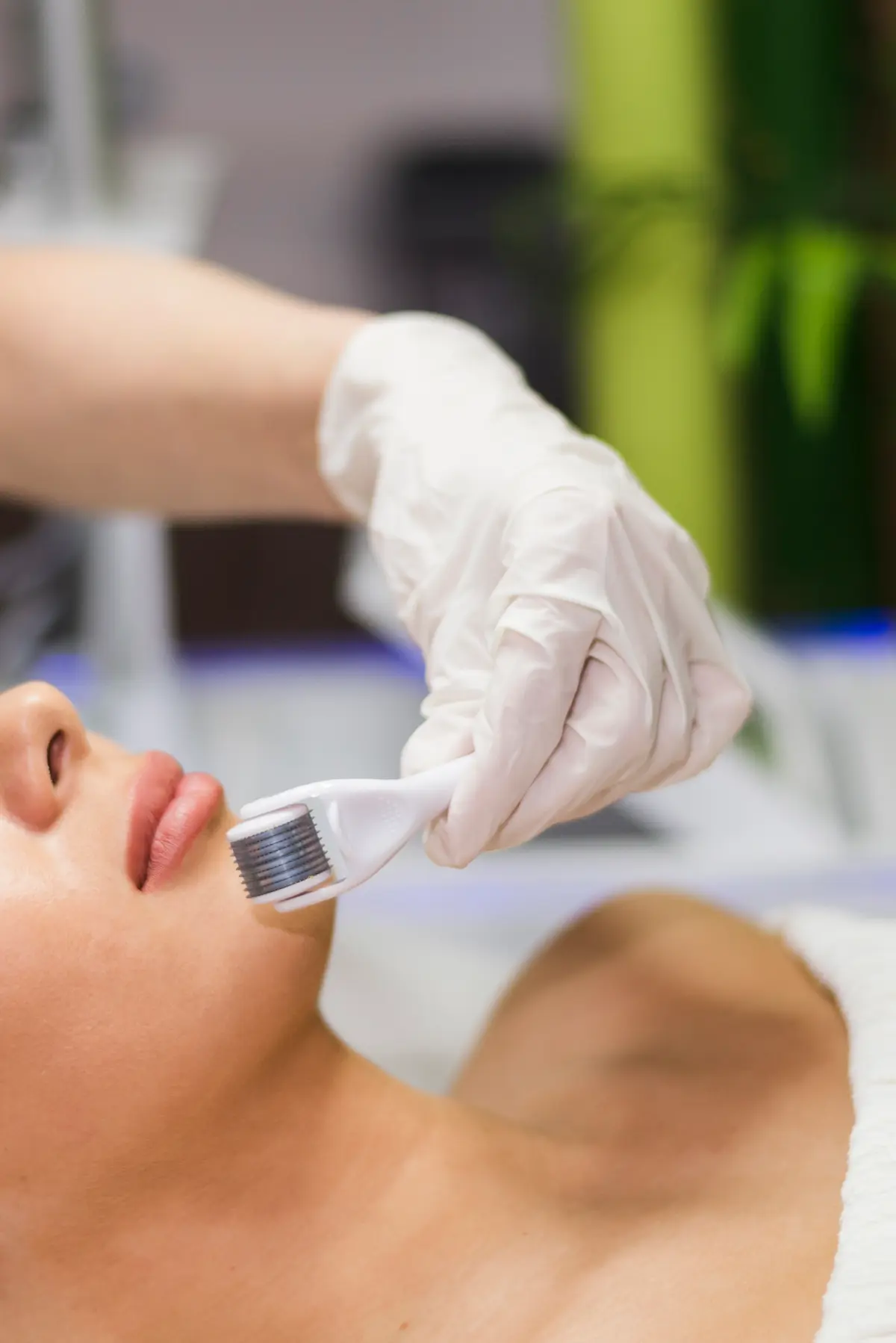 Curso de Mesoterapia para esteticistas: Transformando la Estética con Precisión y Eficacia 2 Tratamiento mesoterapia
