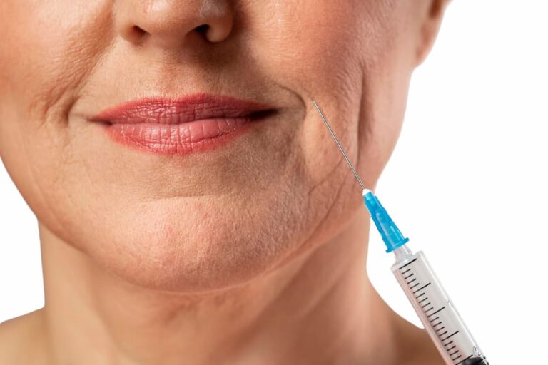 filling facial